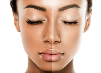 Toning is NOT bleaching - Nkechi Bianze